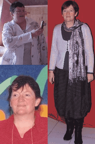 avant apres agnes avant apres